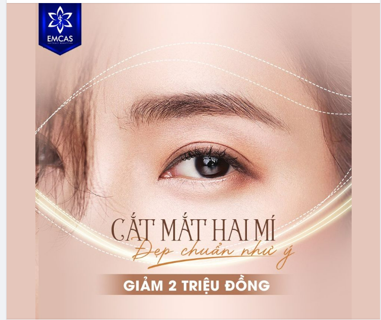 CẮT MẮT HAI MÍ - ĐẸP CHUẨN NHƯ Ý