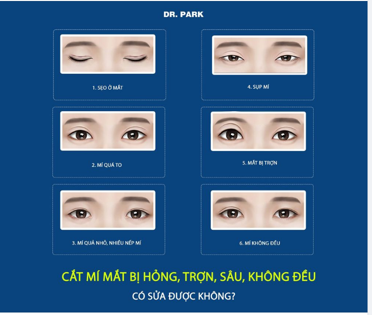 CẮT MÍ HỎNG - CÓ SỬA ĐƯỢC KHÔNG