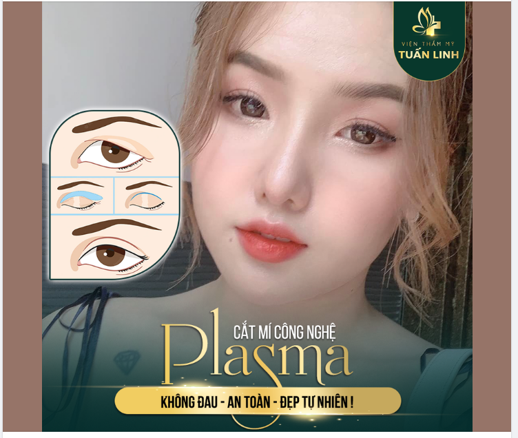 CẮT MÍ - Khắc phục 100% khuyết điểm mắt một mí - sụp mí - nhiều da chùng - nhiều nếp mí.