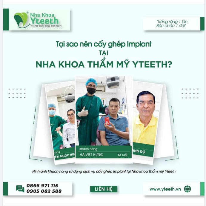 Cấy ghép Implant là kỹ thuật nha khoa vô cùng khó.