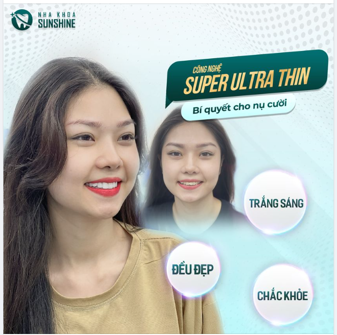 Chỉ sau 2 lần hẹn tại Nha khoa Thẩm mỹ Sunshine.