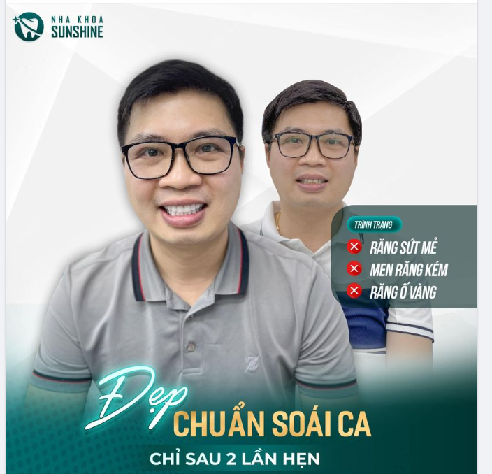 Chỉ sau 48H tại Sunshine, bạn hoàn toàn sở hữu 1 nụ cười ưng ý với hàm răng trắng sáng - chắc khoẻ.