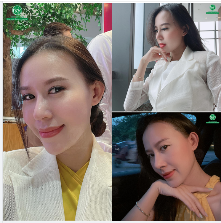 CHIẾC MŨI CHUẨN ĐẸP - KH THẦN THÁI RẠNG NGỜI