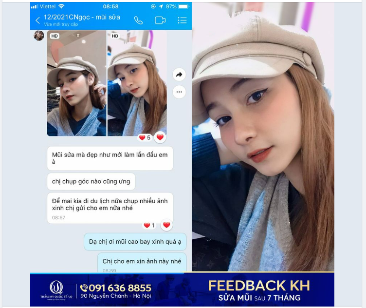 Chính diện tự nhiên - Góc nghiêng sắc nét