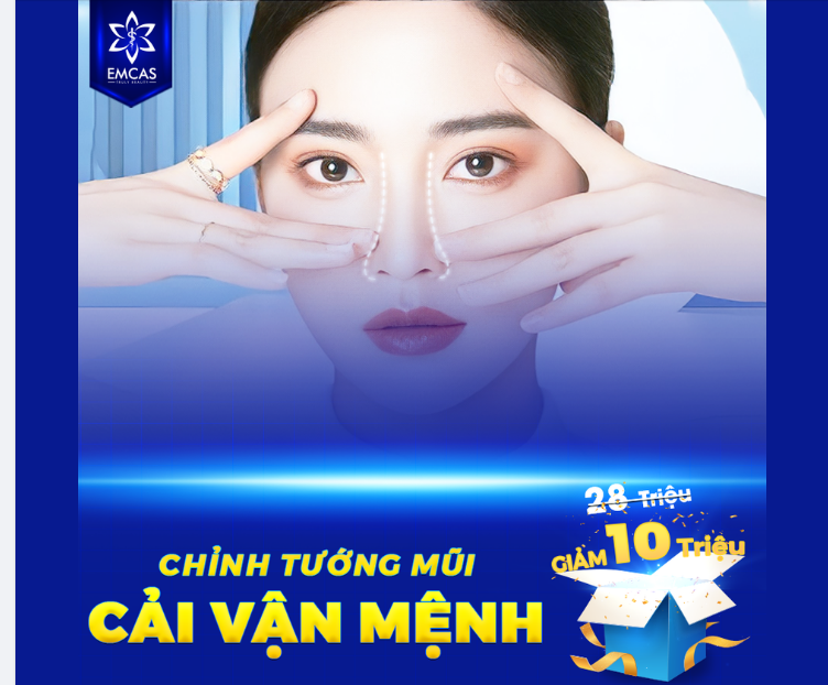 CHỈNH TƯỚNG MŨI - CẢI VẬN MỆNH