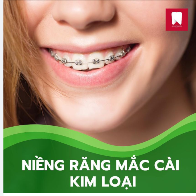 CÓ BAO NHIÊU PHƯƠNG PHÁP NIỀNG RĂNG PHỔ BIẾN 