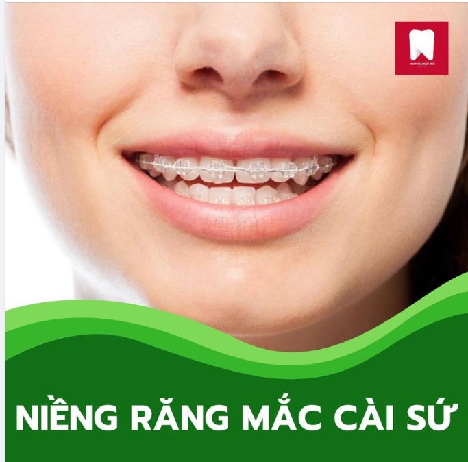 CÓ BAO NHIÊU PHƯƠNG PHÁP NIỀNG RĂNG PHỔ BIẾN 