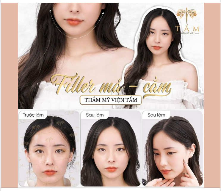 ĐÃ ĐẸP NAY CÒN ĐẸP HƠN CÙNG COMBO FILLER MÁ - CẰM TẠI TẤM