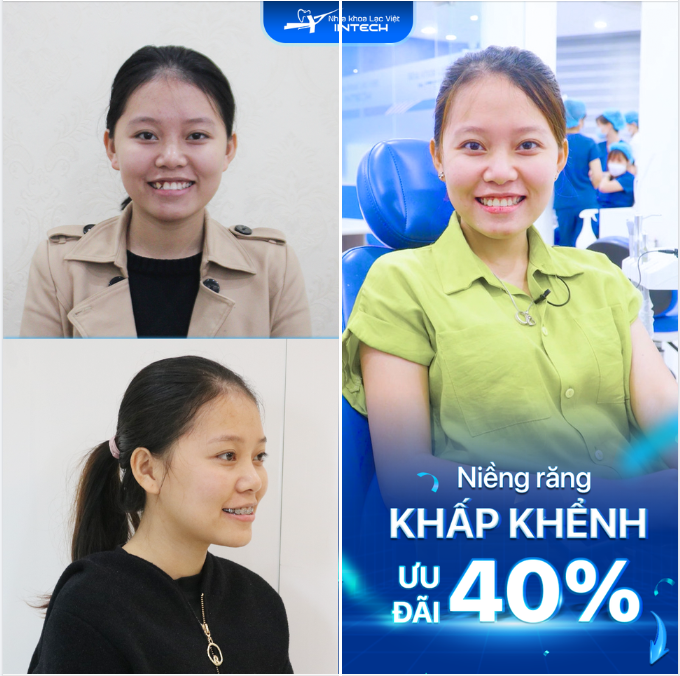 Dàn đều khấp khểnh bằng công nghệ X-Matrix