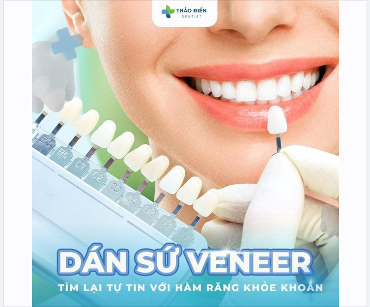 DÁN SỨ VENEER - TÌM LẠI TỰ TIN VỚI NỤ CƯỜI TỎA NẮNG