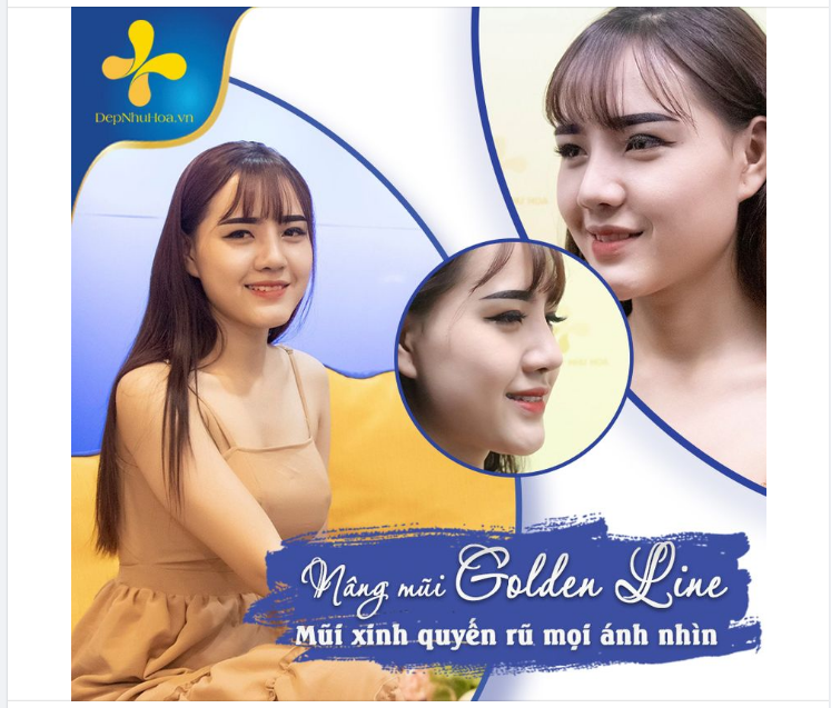 DÁNG MŨI GOLDEN LINE - ĐẸP TINH TẾ ĐẾN TỪNG GÓC NHÌN