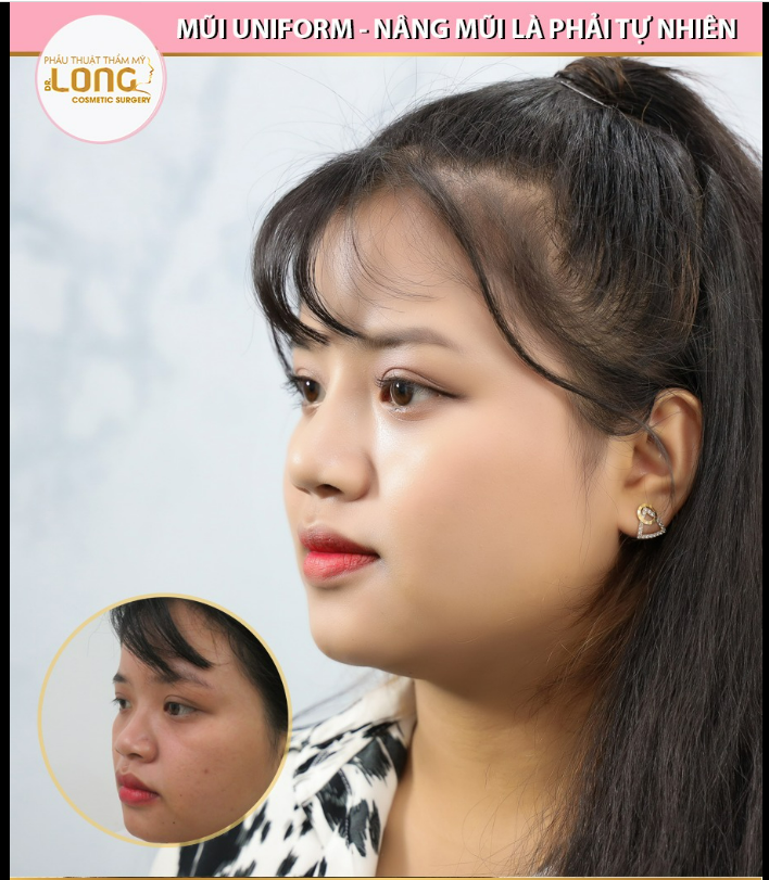 Dáng mũi nổi bật giúp nàng khách thêm xinh đẹp duyên dáng bội phần, mũi thanh tú hài hòa với khuôn mặt.