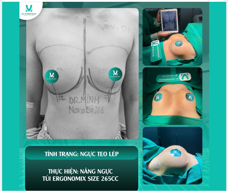 DÁNG NGỰC ĐẸP, SEXY NGAY SAU LÀM