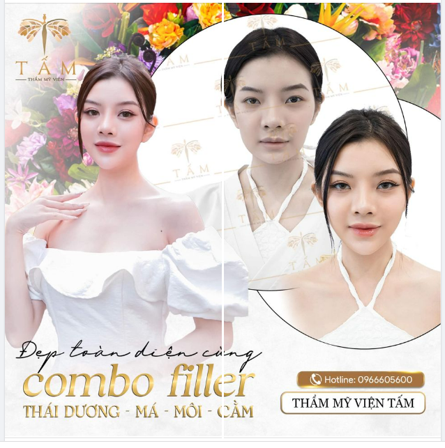 ĐẸP TOÀN DIỆN CÙNG FILLER THÁI DƯƠNG - MÁ MÔI - CẰM