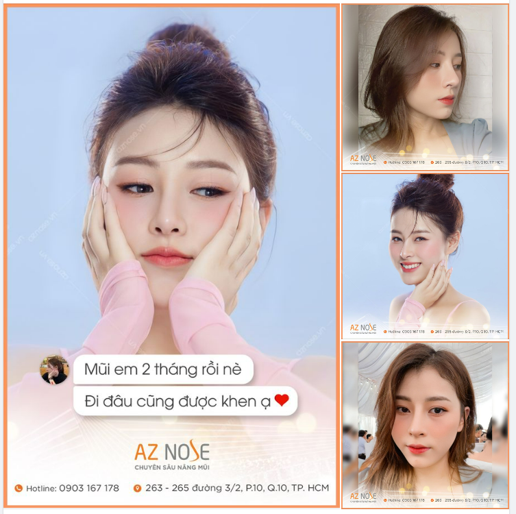 Đi đâu cũng được mọi người khen mũi đẹp hết ạ!