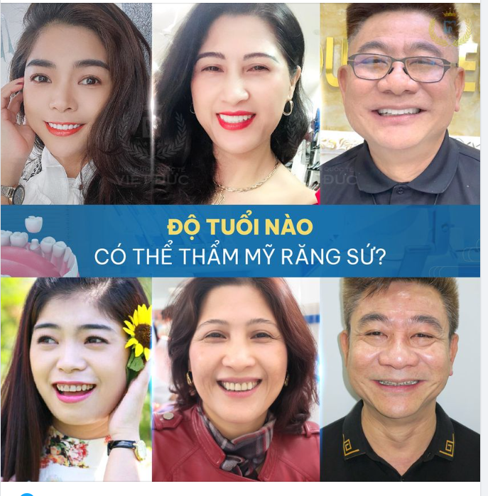 ĐỘ TUỔI CÓ THỂ THỰC HIỆN THẨM MỸ RĂNG SỨ ?