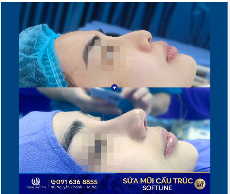 Dr Vũ Quang - Tái sinh mũi hỏng - Vực dậy niềm tin