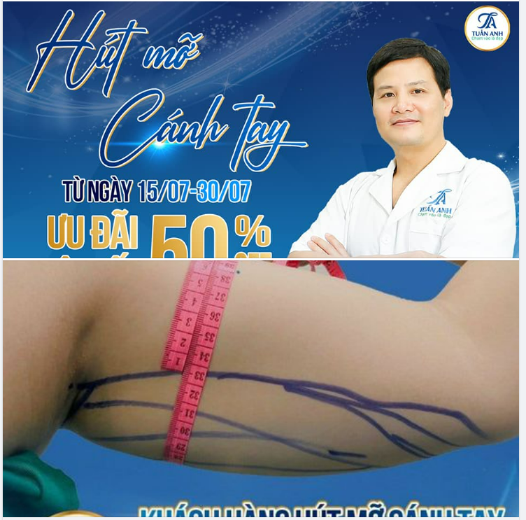Đừng để cánh tay to, thô cản trở việc diện đồ thoải mái ngày hè