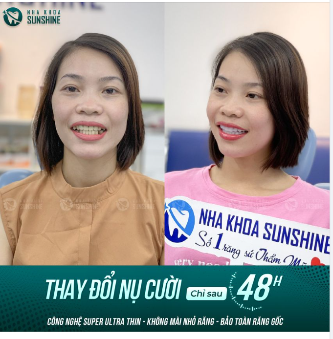Đừng để "nụ cười kém duyên" làm ảnh hưởng đến cuộc sống của bạn.