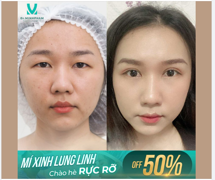 Đừng vì cảm thấy tự ti về những khuyết điểm của đôi mắt mà đánh mất đi cơ hội thành công.