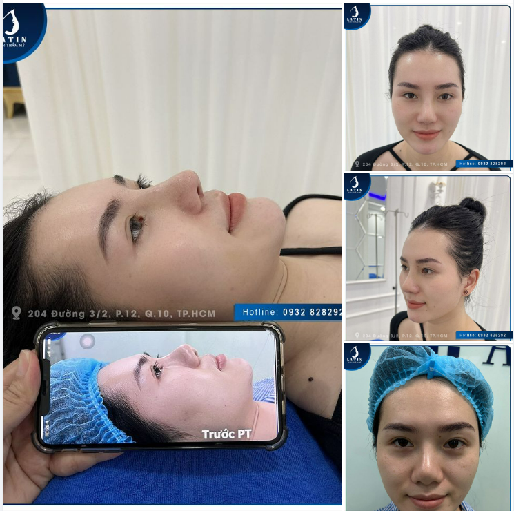 FEEDBACK 10 ngày thay đổi cho chị khách hàng xinh đẹp