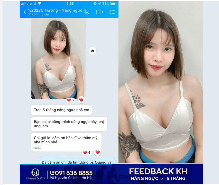 Feedback chân thực từ khách hàng luôn là minh chứng vững vàng và đáng tin cậy nhất cho thương hiệu Nâng vòng 1 nội soi công nghệ cao của Bác sĩ Vũ Quang