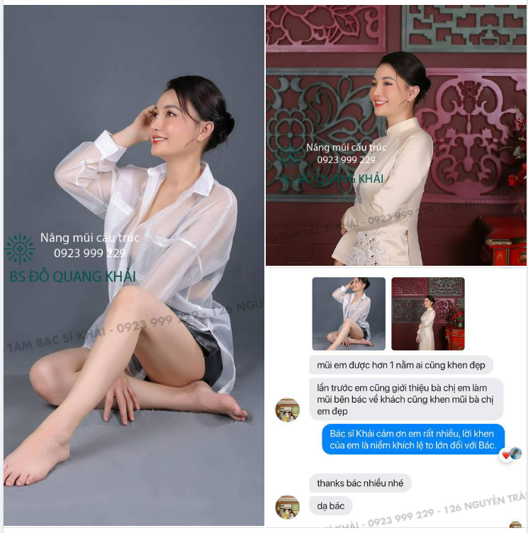 FEEDBACK CỦA KHÁCH HÀNG SAU 1 NĂM NÂNG MŨI