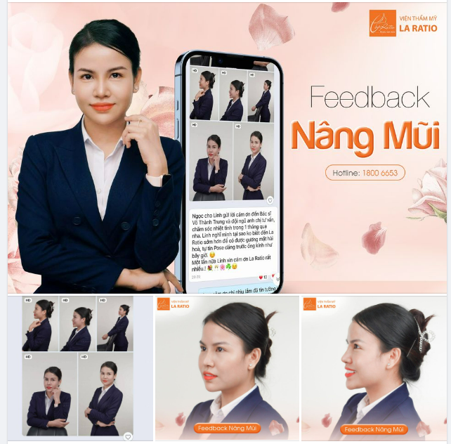 Feedback Khách hàng Nâng mũi tại La Ratio