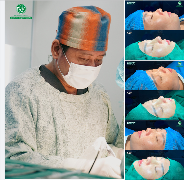 FORM MŨI CAO XINH - KHUÔN MẶT THANH TÚ