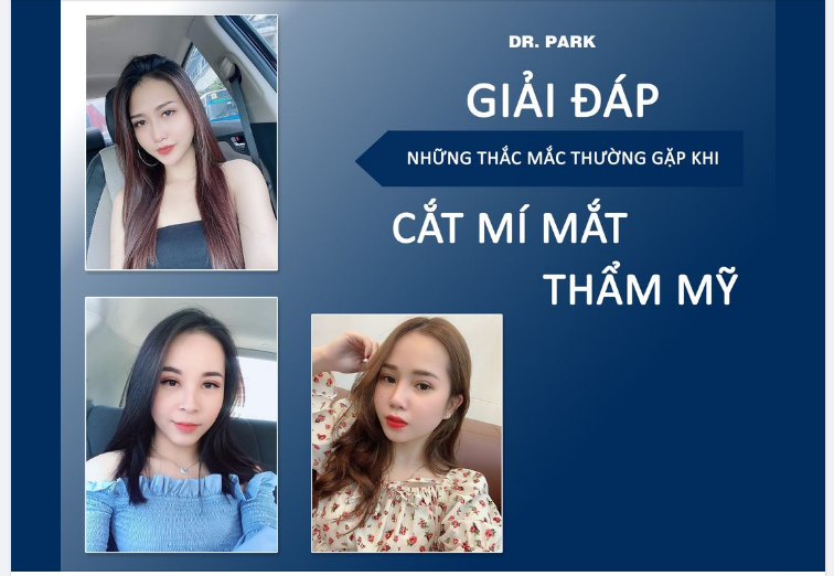 GIẢI ĐÁP NHỮNG THẮC MẮC THƯỜNG GẶP KHI CẮT MÍ MẮT