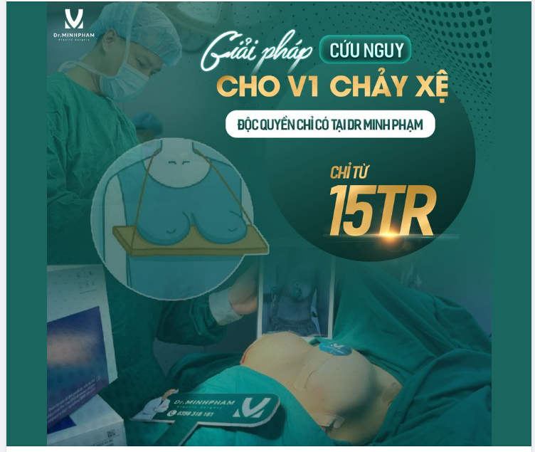 Giải pháp cứu nguy cho v1 chảy x.ệ - Độc quyền chỉ có tại Dr Minh Phạm
