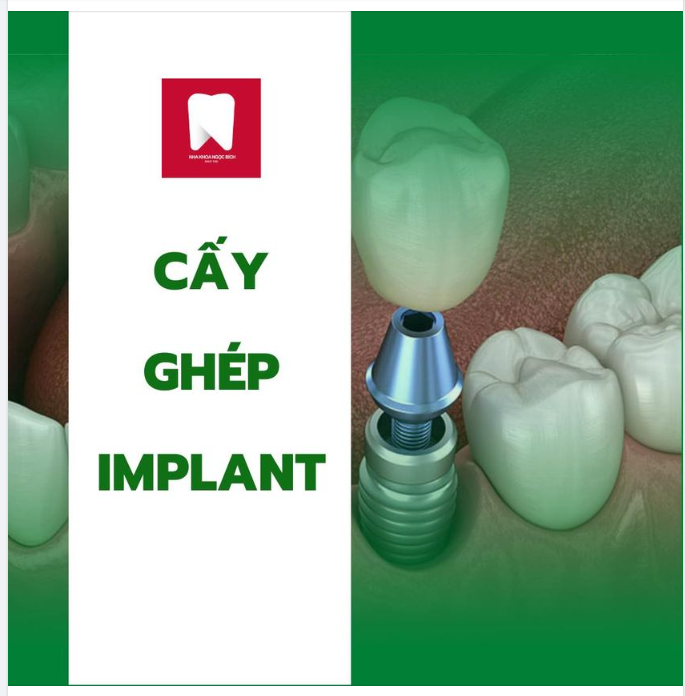 GIẢI PHÁP NÀO CHO NGƯỜI BỊ MẤT RĂNG LÂU NĂM