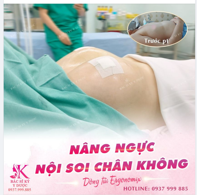 Giải pháp nào giành cho ngực nép
