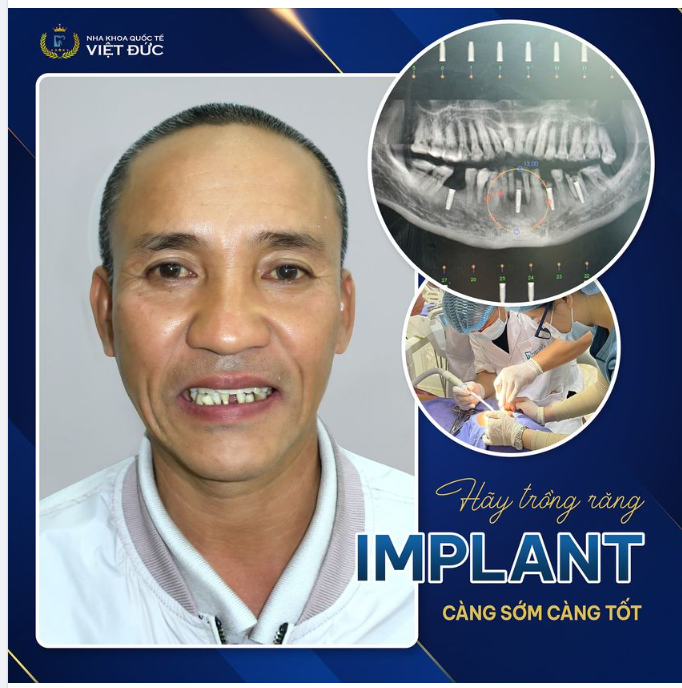 GIỮ TIỀN NHIỀU LÀM GÌ NẾU KHÔNG CÓ RĂNG ĂN NHAI