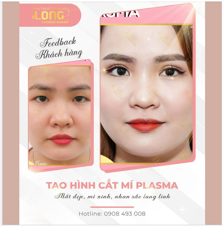 Gỡ nút cho sự tự tin này ngay chỉ sau 30 phút….nhận ngay thông điệp “XINH ĐẸP” đến từ PTTM Bác sĩ Long