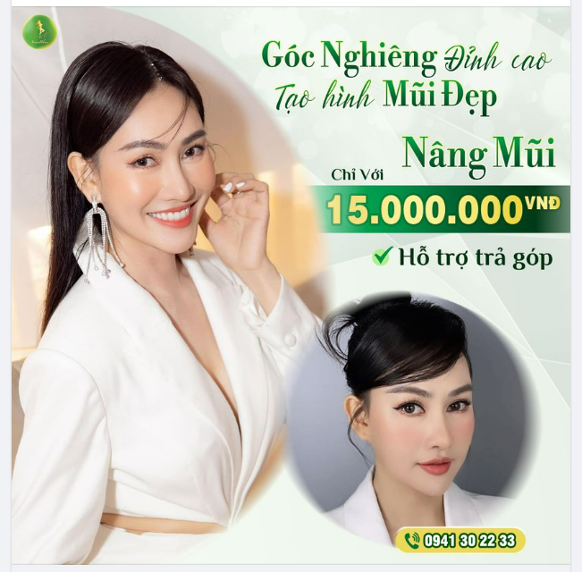 GÓC NGHIÊNG ĐỈNH CAO, TẠO HÌNH MŨI ĐẸP