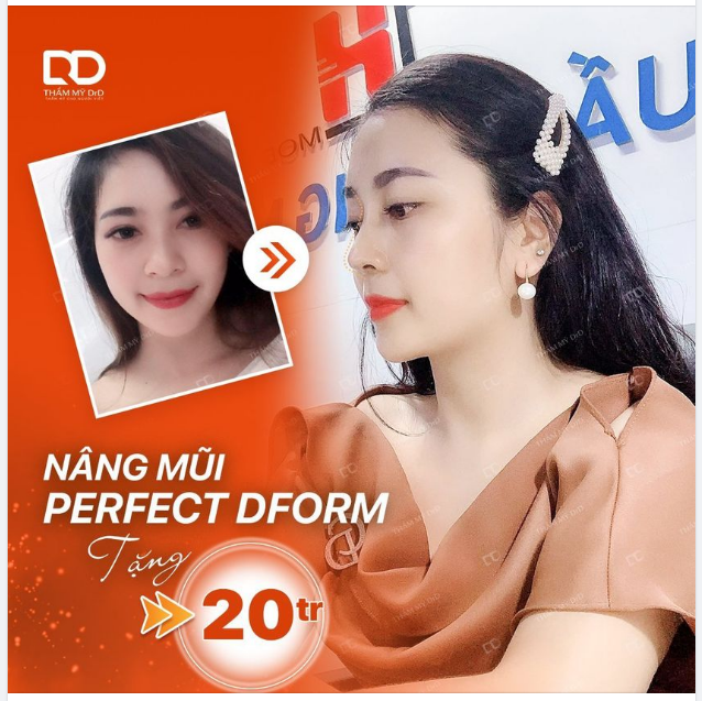 GÓI NÂNG MŨI PERFECT DFORM TẠI DrD CÓ GÌ