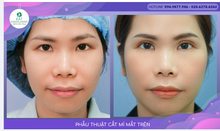 Hạnh phúc nhất của team KAT là luôn được khách hàng chủ động feedback lại những hình ảnh kèm với sự hài lòng .