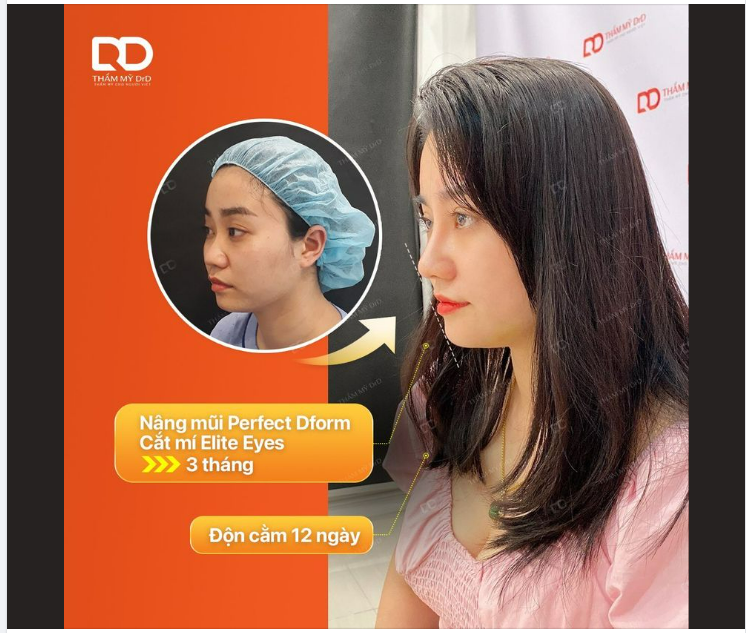 Hãy cân nhắc trước khi đến DrD, bởi đến là sẽ bị nghiện làm đẹp đó.