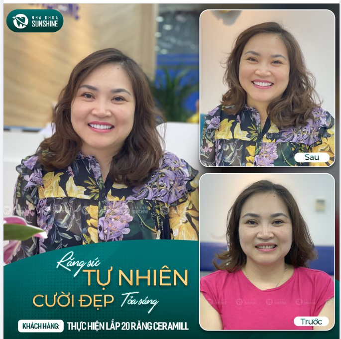 Hãy quan tâm đến răng miệng của bản thân nhiều hơn, trước khi quá muộn nha.
