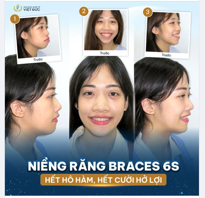 HẾT HÔ HÀM - HẾT CƯỜI HỞ LỢI