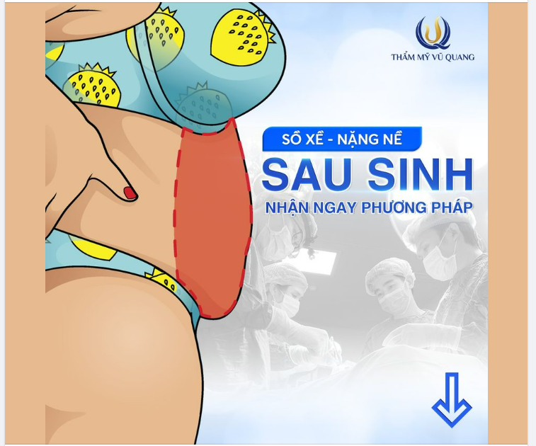 Hết ì ạch, xồ xề sau sinh chỉ sau 60P