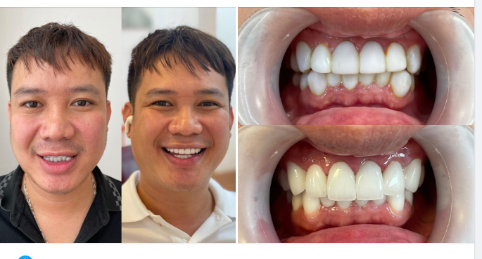 Hi vọng quãng đời còn lại, bạn sẽ trở thành người trong mắt có mặt trời, trong nụ cười có sự thản nhiên…