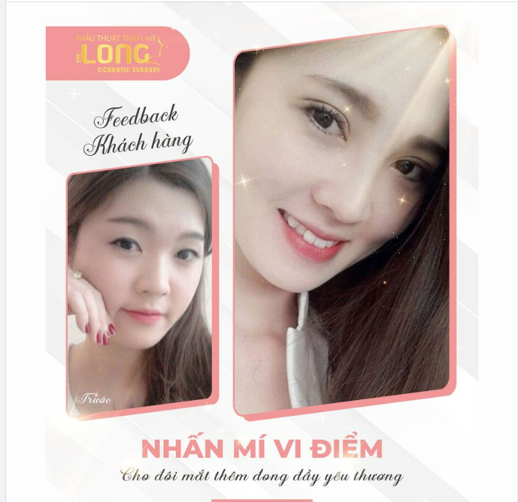 HÌNH ẢNH KHÁCH HÀNG SAU KHI ĐƯỢC NHẤN MÍ MẮT