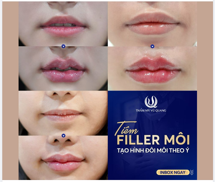 Hình ảnh thực tế các KH nhà VQ, mời cả nhà tham khảo