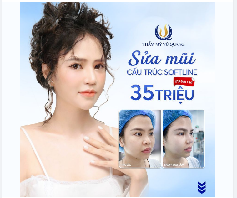 HOT - Sửa mũi cấu trúc Softline - Ưu đãi chỉ còn 35tr