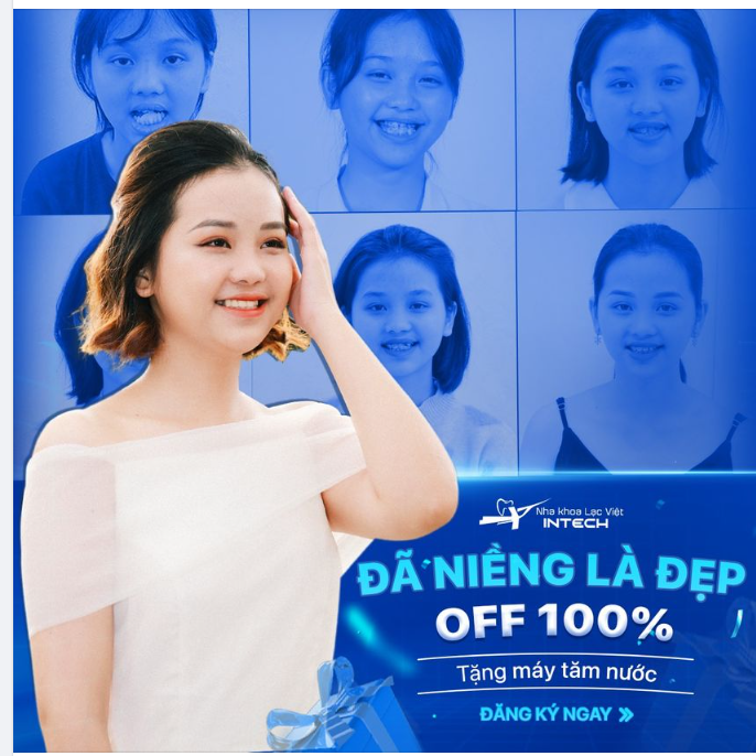HOT - Tài trợ 100% chi phí niềng răng – 3 suất duy nhất