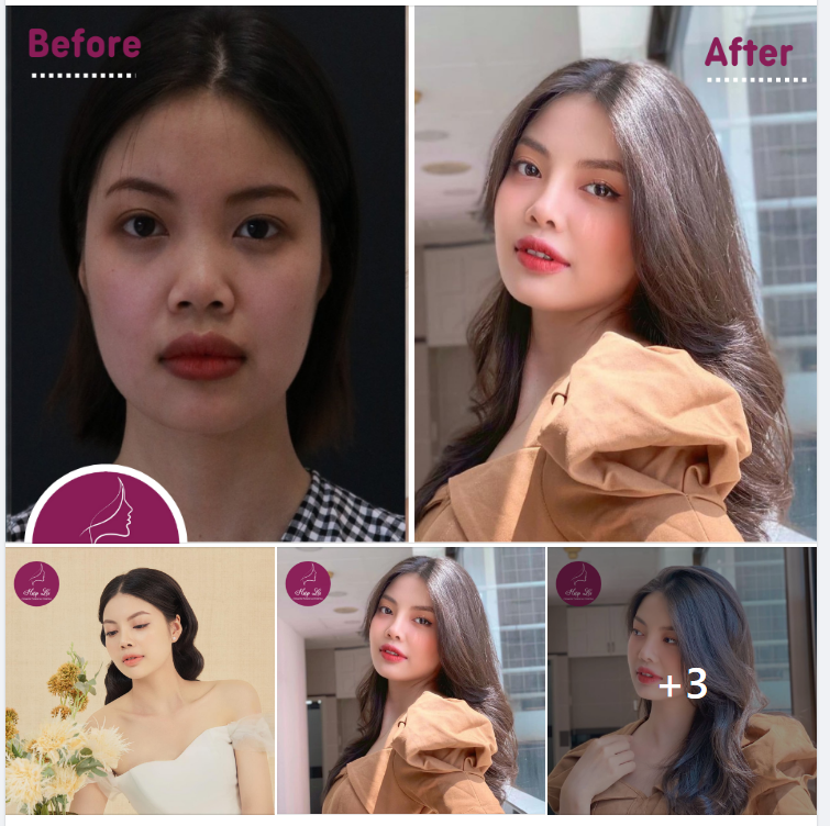 HOTGIRL HƯƠNG NGUYỄN  HÀNH TRÌNH ĐẠT ĐẾN VẺ ĐẸP HOÀN HẢO