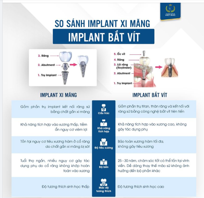 IMPLANT - HIỂU KỸ PHƯƠNG PHÁP ĐỂ ĐƯA RA LỰA CHỌN CHÍNH XÁC