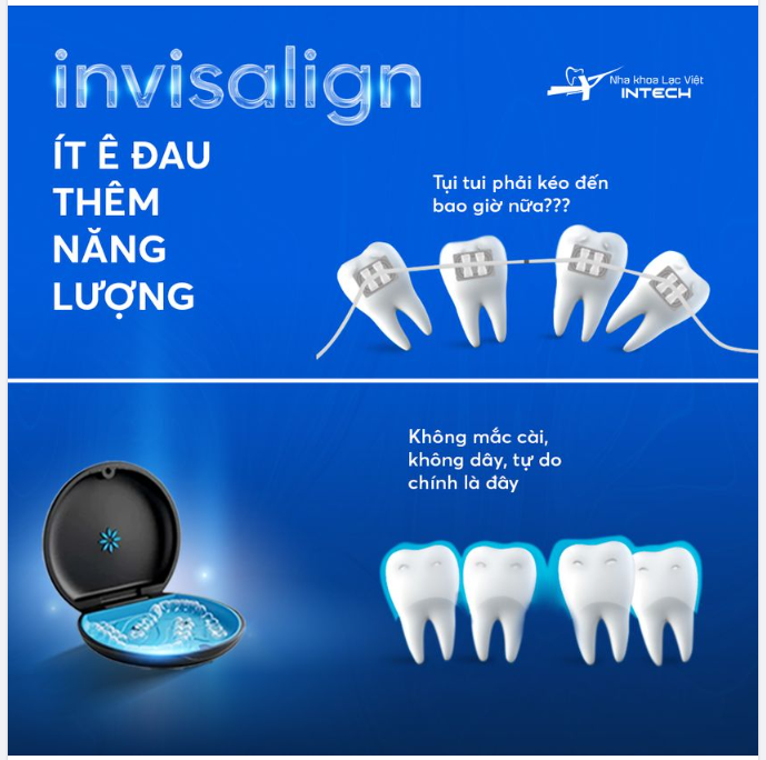 INVISALIGN - ÍT ĐAU BUỐT CHO NGÀY DÀI NĂNG LƯỢNG